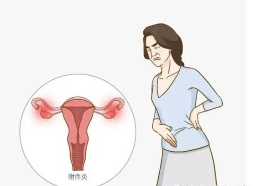 附件炎为什么会引起不孕