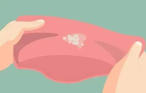 治疗白带异常多少钱