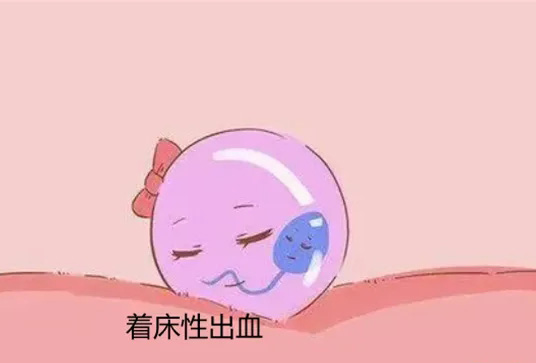 孕早期出血的症状有哪些