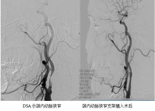 庐江县人民医院神经内科